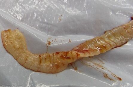 Parasites in the body